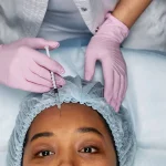 Botox & Dermal